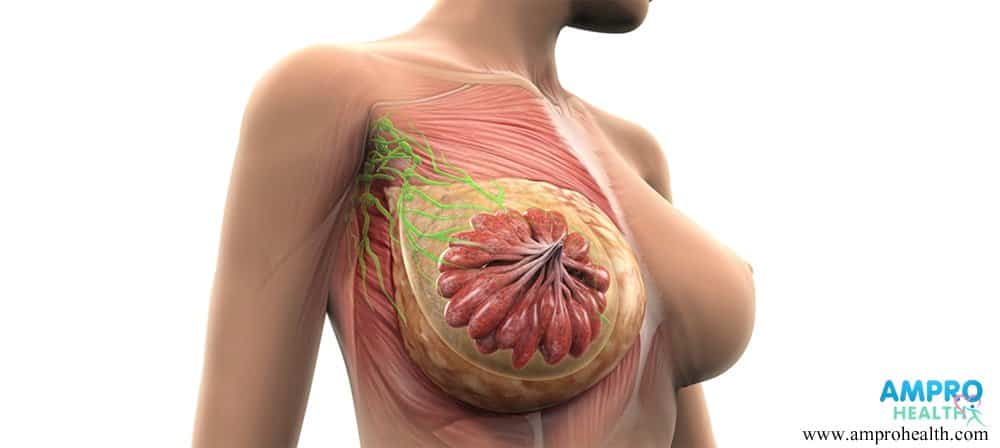 มะเร็งเต้านม (Breast Cancer) มะเร็งเต้านม (Breast Cancer)