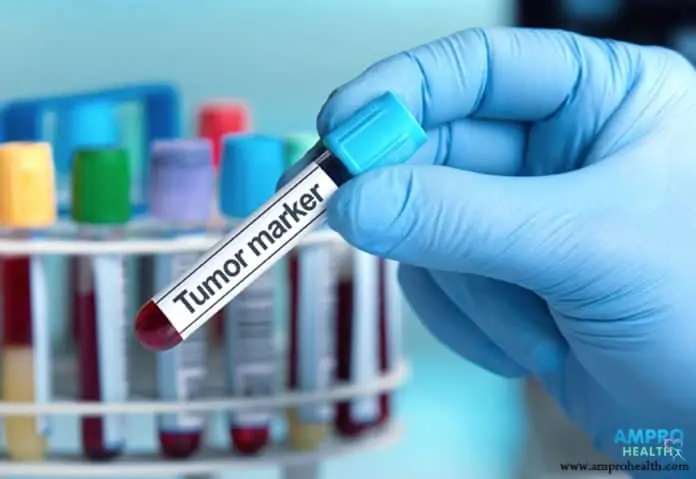 การตรวจหาสารมะเร็ง – Tumor Marker