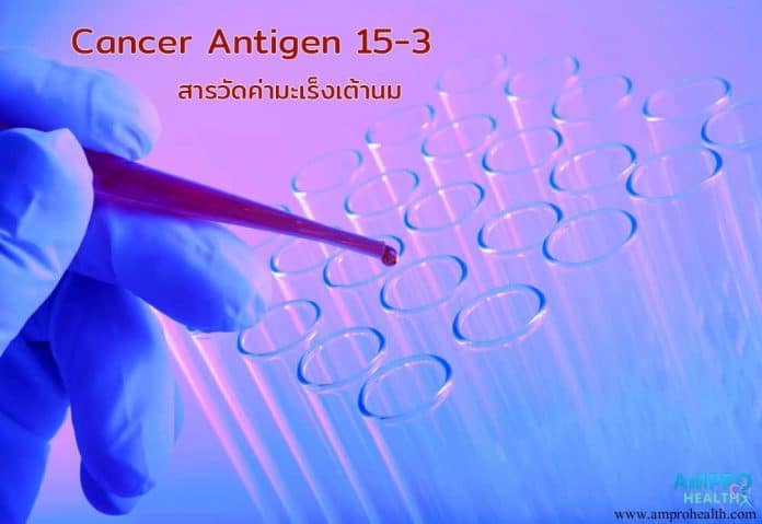 Cancer Antigen