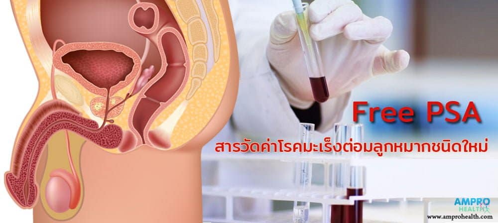 Free PSA สารวัดค่าโรคมะเร็งต่อมลูกหมากชนิดใหม่