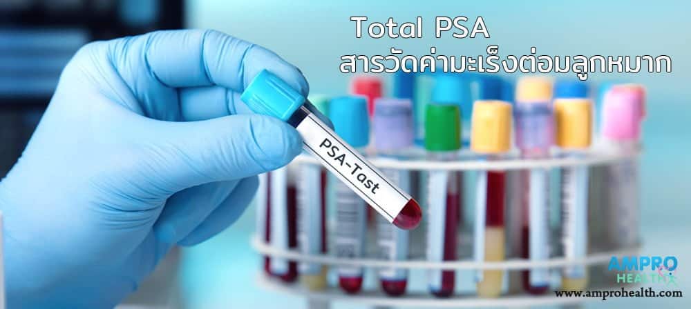 Total PSA สารตรวจวัดค่ามะเร็งต่อมลูกหมาก