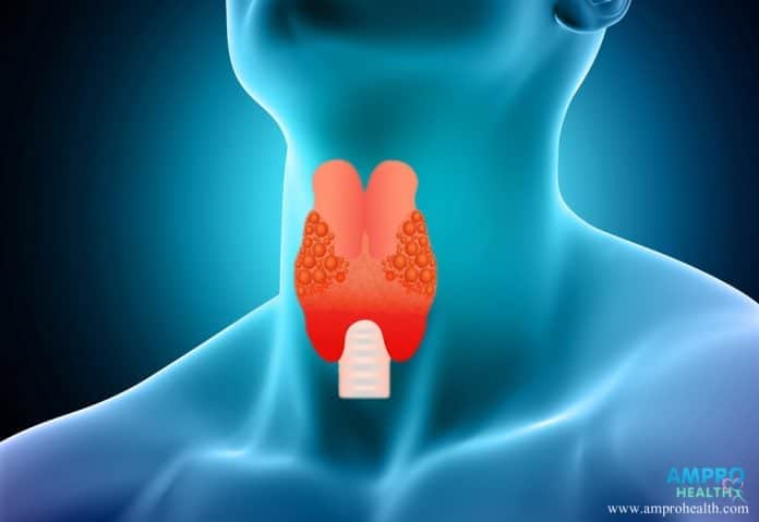 โรคมะเร็งต่อมไทรอยด์ (Thyroid Cancer)