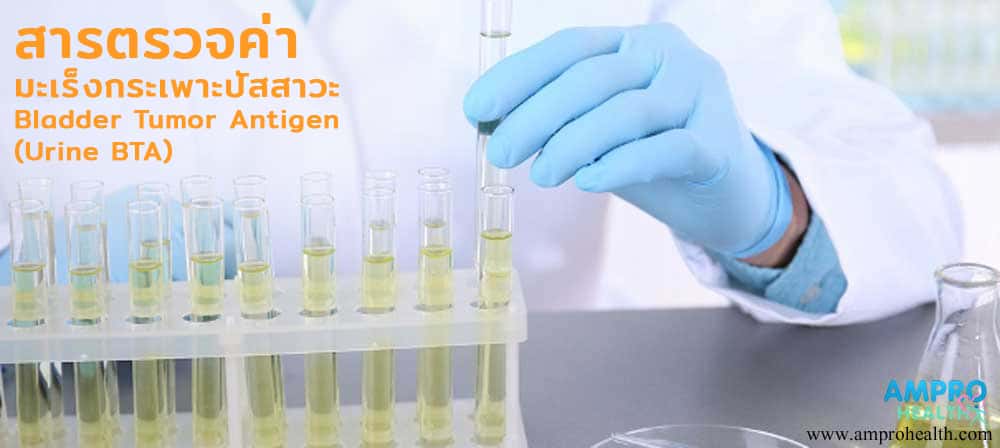 Urine BTA,มะเร็งกระเพาะปัสสาวะ,มะเร็ง,สารวัดค่ามะเร็ง