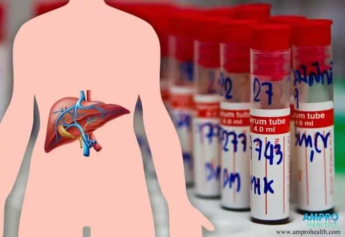 การตรวจสาร Alkaline Phosphatase ในตับ