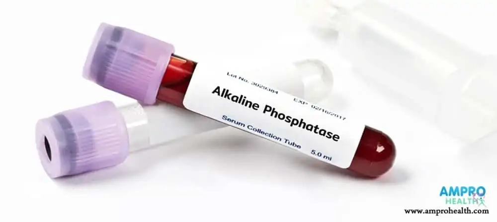 การตรวจสาร Alkaline Phosphatase ในตับ