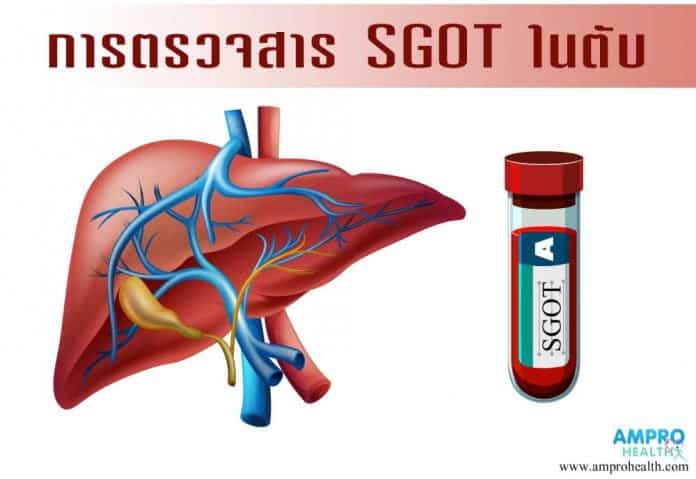 การตรวจหาสาร SGOT ในตับ (เอส จี โอ ที)