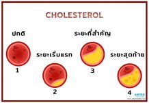 คอเลสเตอรอล ( Cholesterol ) ดีหรือไม่ดีต่อร่างกายอย่างไร
