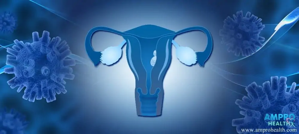 สาเหตุ อาการและวิธีการรักษาโรคมะเร็งเยื่อบุโพรงมดลูก (Endometrial Cancer)