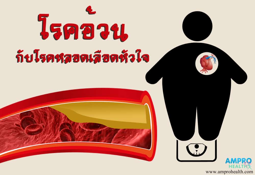 โรคอ้วนกับโรคหลอดเลือดหัวใจ (Obesity and coronary artery disease) โรคอ้วนกับโรคหลอดเลือดหัวใจ (Obesity and coronary artery disease)