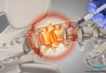 Bone Markers คืออะไร? การตรวจค่าที่บ่งบอกสัญญาณโรคกระดูก การตรวจเลือดหาสัญญาณโรคกระดูก