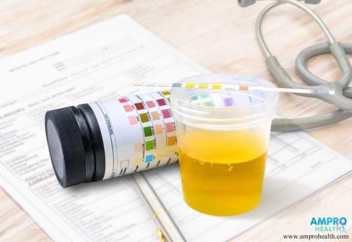 การตรวจปัสสาวะหาค่าความผิดปกติของร่างกาย (Urinalysis)