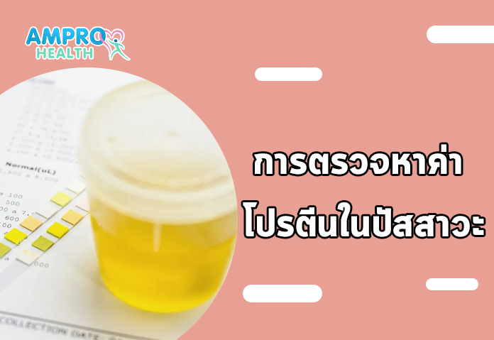 การตรวจหาค่า โปรตีนในปัสสาวะ