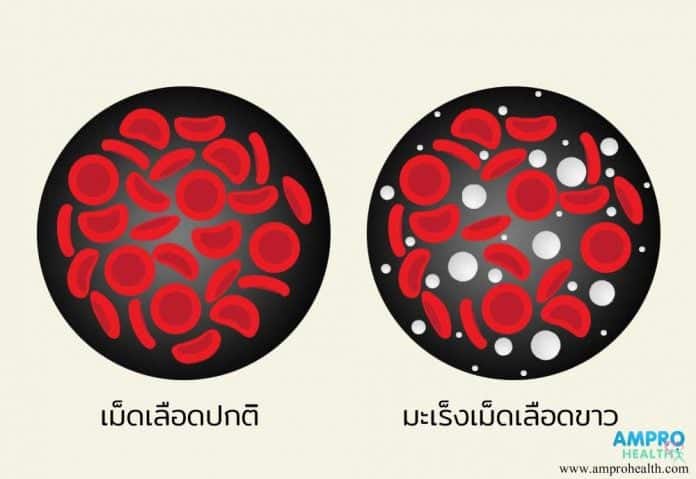 ชนิดของมะเร็ง และเซลล์ต้นกำเนิดมะเร็งชนิดต่าง ๆ ในร่างกาย