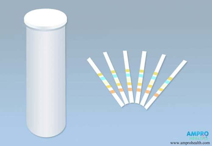 การตรวจปัสสาวะหาค่า Urine Glucose