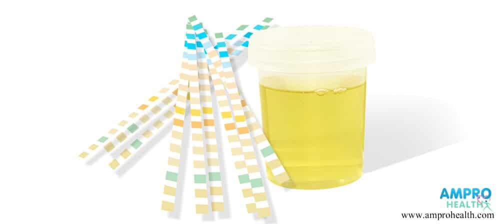 การตรวจปัสสาวะหาค่า Urine Spot MAU/creatinine ratio