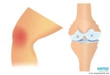 วิธีดูแลตัวเองให้ห่างไกลโรคข้อและกระดูก วิธีดูแลตัวเองให้ห่างไกลโรคข้อและกระดูก