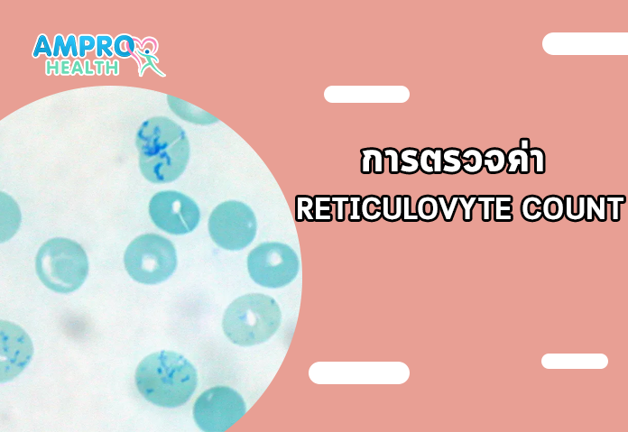 การตรวจค่า RETICULOVYTE COUNT - ค่า ESR บอกสัญญาณอะไรในร่างกาย เรียนรู้เพื่อการป้องกันโรค