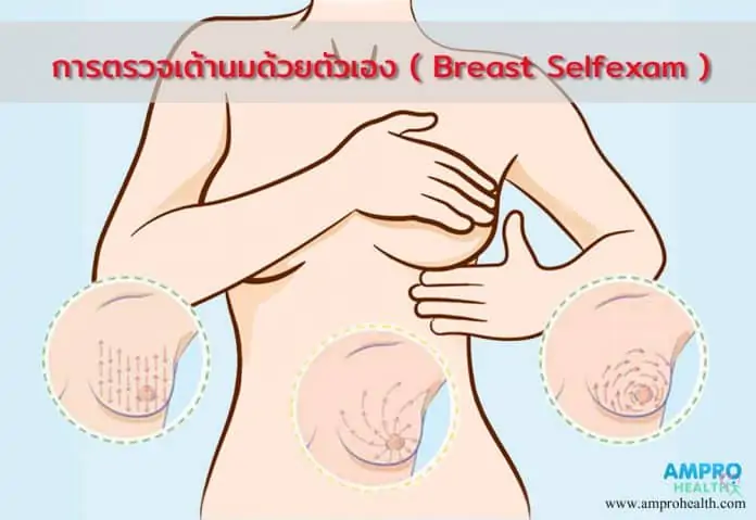 ตรวจเต้านมด้วยตัวเอง ( Breast Selfexam )