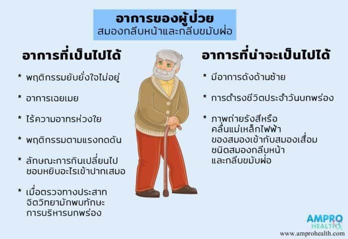 โรคสมองเสื่อมวัยกลางคน (Early Onsel Dementia)