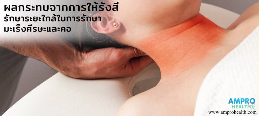 ผลกระทบจาการฉายรังสีในการรักษามะเร็งบริเวณศีรษะและคอ