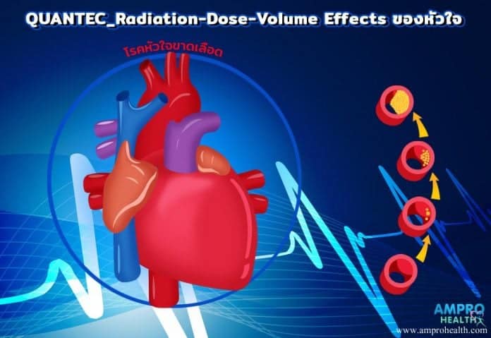 การฉายรังสีรักษามะเร็งมีผลกระทบจากต่อหัวใจอย่างไร