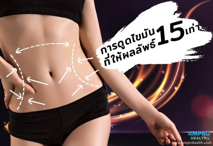 การดูดไขมันที่ให้ผลลัพธ์ 15 เท่า