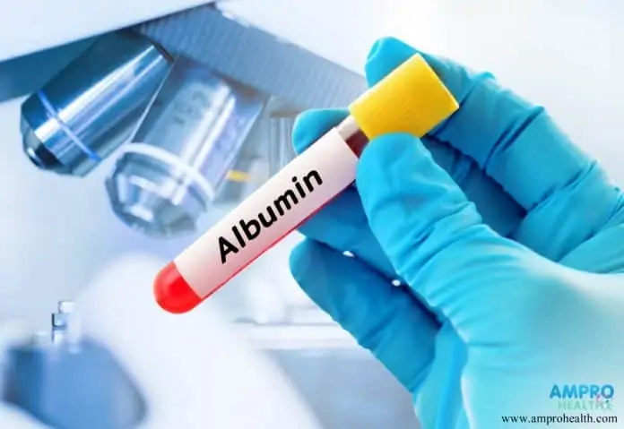 การตรวจ Albumin ในเลือดจำเป็นอย่างไร