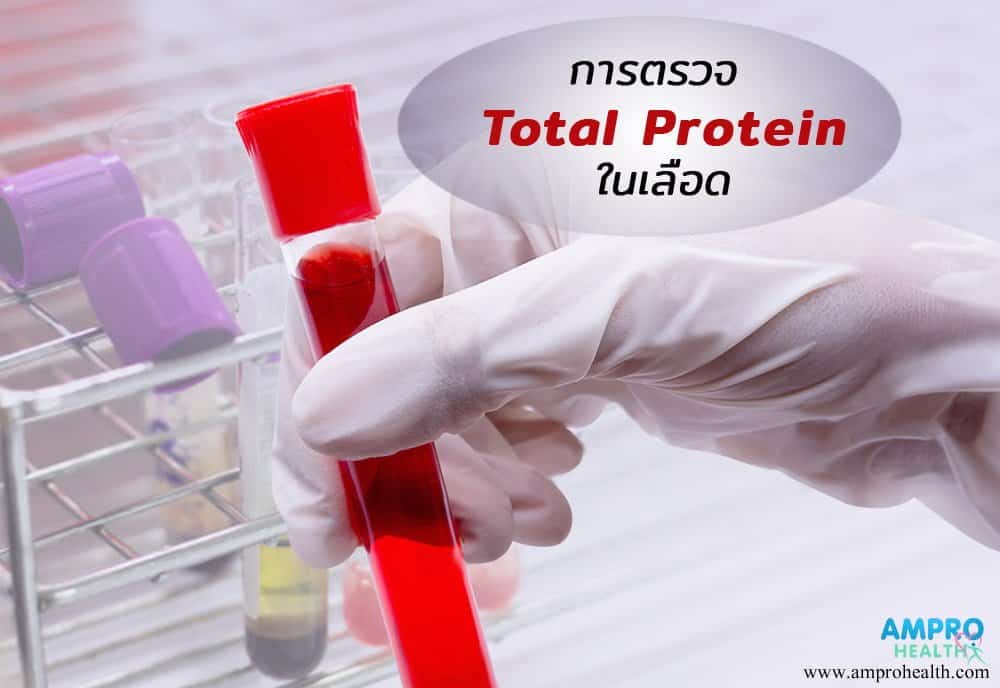 การตรวจ Total Protein บ่งบอกอะไร AM Pro Health