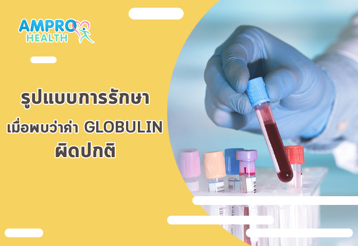 รูปแบบการรักษาเมื่อพบว่าค่า Globulin ผิดปกติ