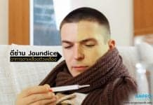 ดีซ่าน ( Jaundice ) อาการ สาเหตุ โรคดีซ่าน ( Jaundice )