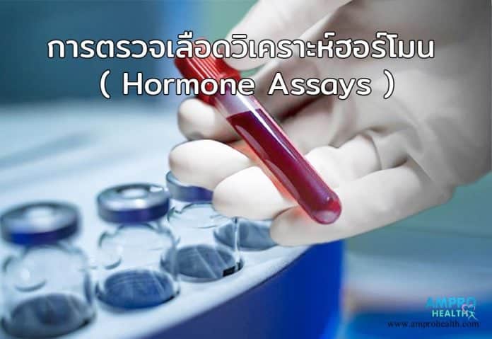 การตรวจเลือดวิเคราะห์ฮอร์โมน ( Hormone Assays )