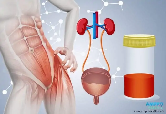 อาการปัสสาวะเป็นเลือด ( Hematuria )