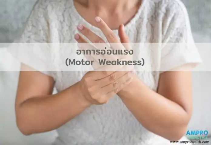 อาการอ่อนแรง ( Motor Weakness )