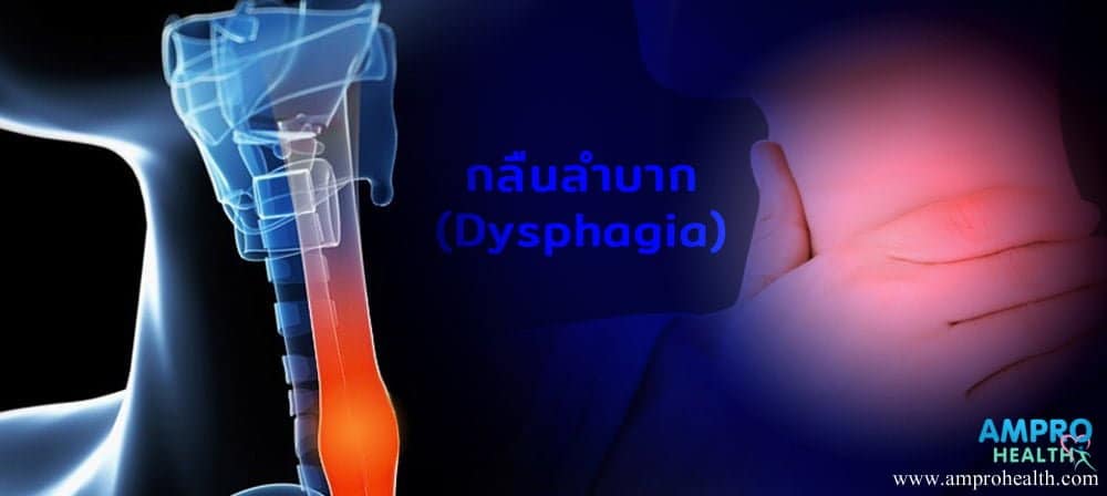 อาการกลืนลำบาก ( Dysphagia )