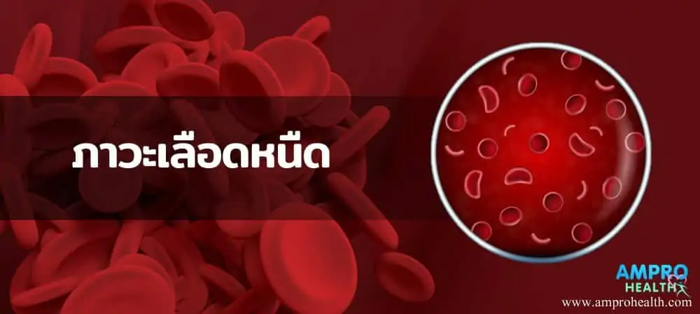 ภาวะเลือดหนืด - ภาวะเลือดหนืด ( Polycythemia )