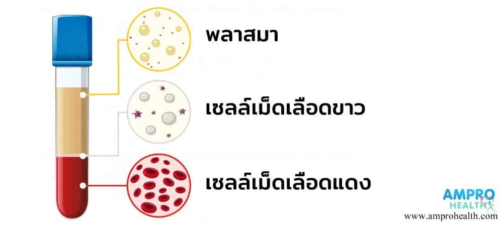 สภาวะเม็ดเลือดขาวสูง ( Leukocytosis )