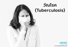 วัณโรค ( Tuberculosis ) เกิดได้อย่างไรกัน