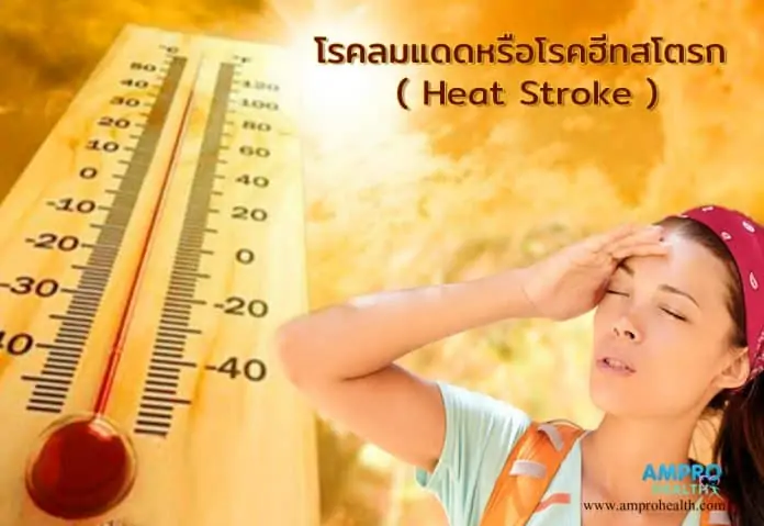 โรคลมแดดหรือโรคฮีทสโตรก ( Heat Stroke )