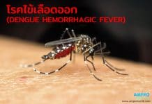 ไข้เลือดออก ( Dengue hemorrhagic fever ) ไข้เลือดออก ( Dengue hemorrhagic fever )