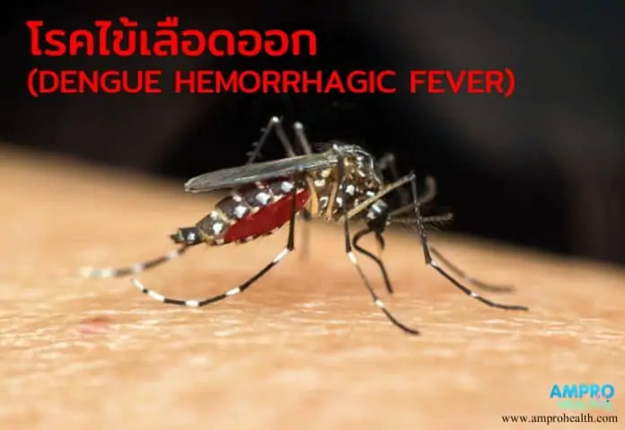 ไข้เลือดออก ( Dengue hemorrhagic fever )