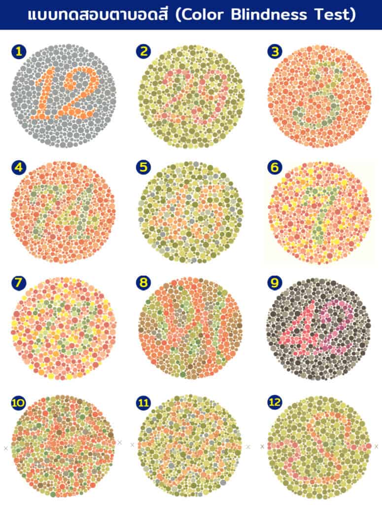 ตาบอดสี เกิดจากสาเหตุอะไร รวมวิธีทดสอบตาบอดสี