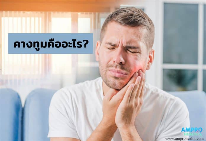 โรคคางทูม ( Mumps ) คืออะไร ?