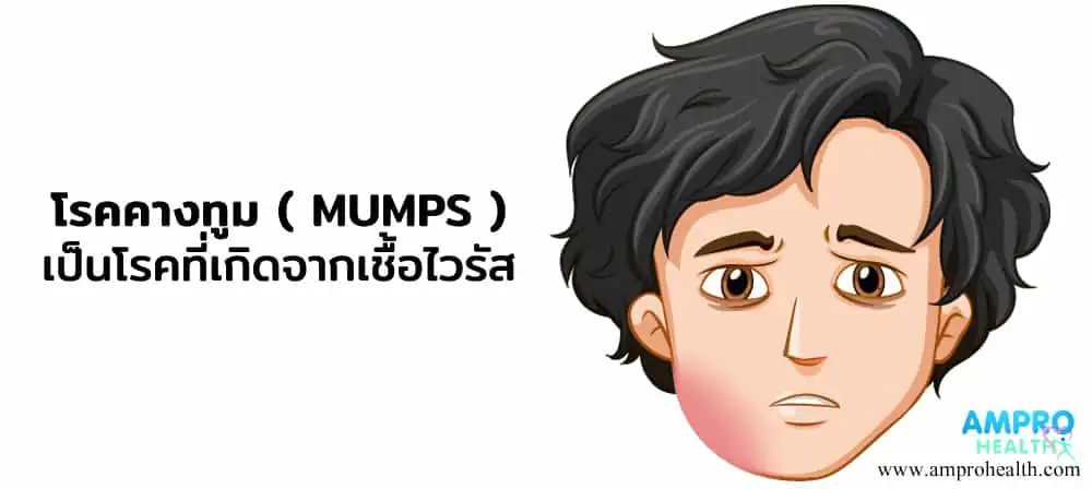 โรคคางทูม ( Mumps ) คืออะไร ?