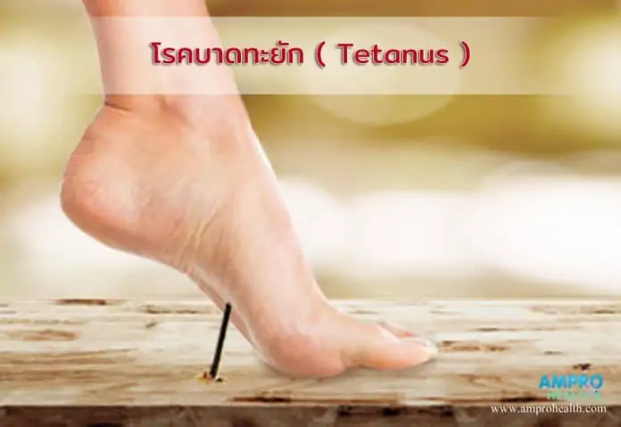 โรคบาดทะยัก ( Tetanus )