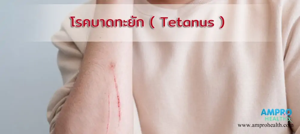 โรคบาดทะยัก ( Tetanus )