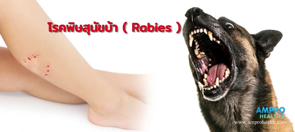 โรคพิษสุนัขบ้า ( Rabies )