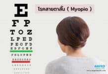 โรคสายตาสั้น ( Myopia ) โรคสายตาสั้น ( Myopia )