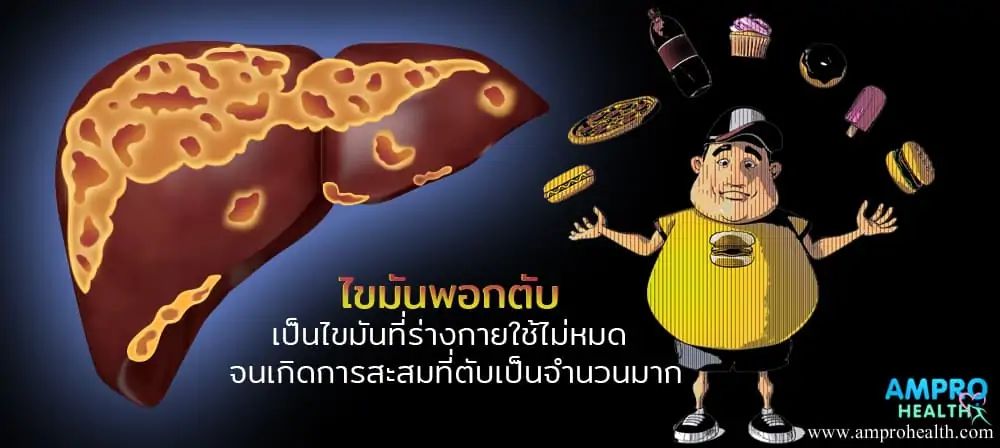โรคไขมันพอกตับ ( Fatty liver disease )