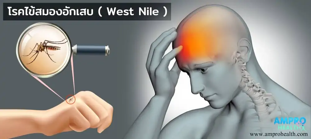 โรคไข้สมองอักเสบ ( West Nile )
