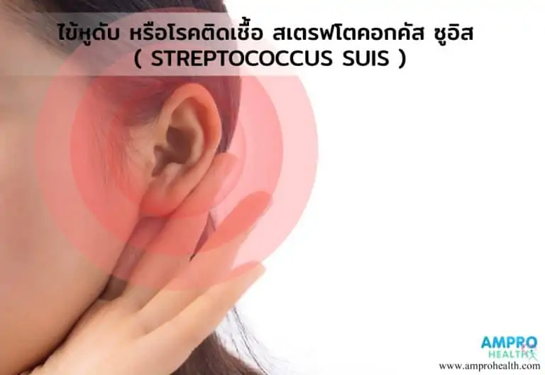 ไข้หูดับ หรือโรคติดเชื้อ สเตรฟโตคอกคัส ซูอิส ( Streptococcus suis )